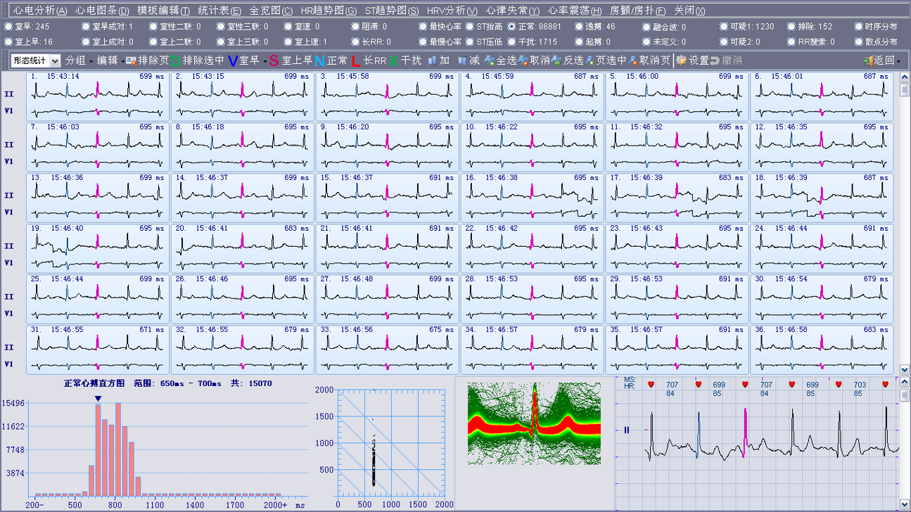 动态心电血压阅图分析软件