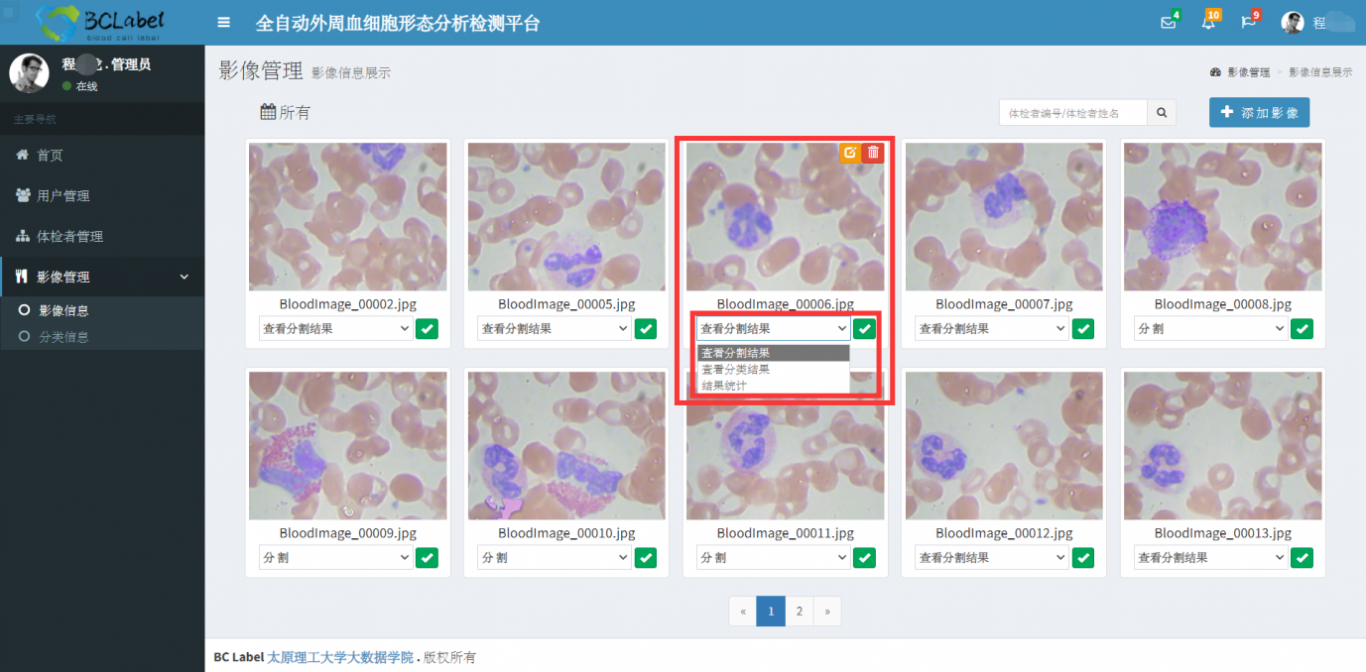 全自动外周血细胞形态分析平台