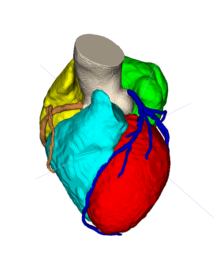 冠脉CTA心脏分割，冠脉分割等