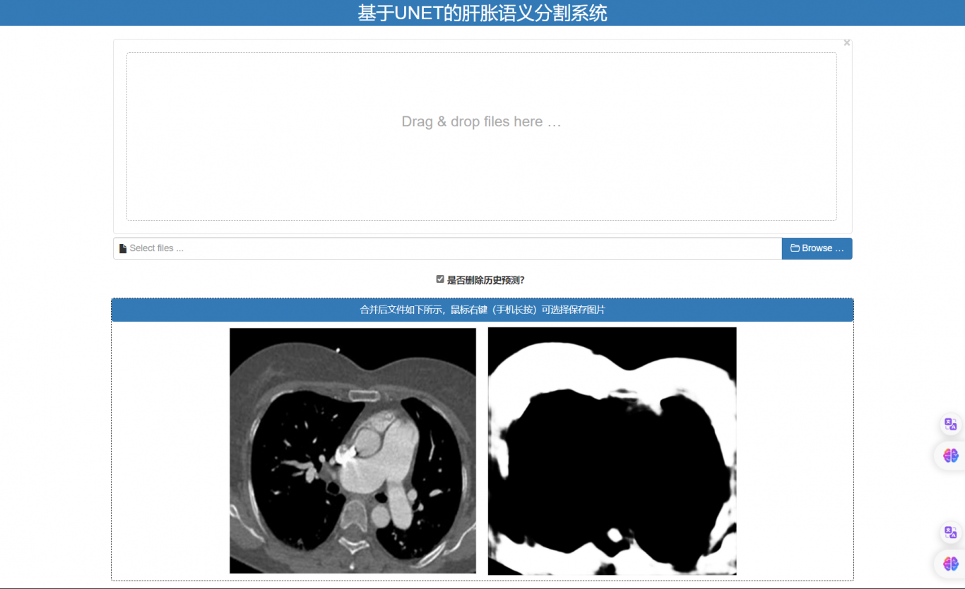 基于Unet的肝胀CT图像语义分割系统