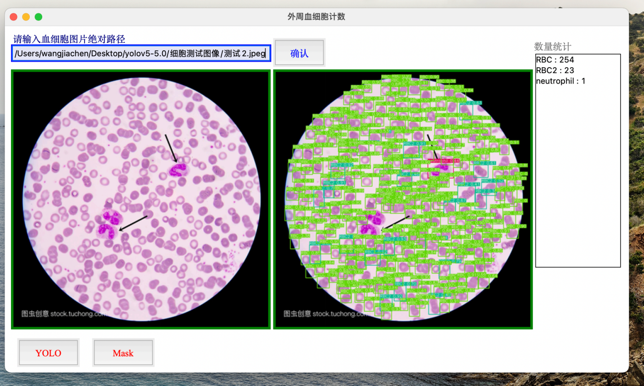 基于YOLO算法的血细胞计数程序