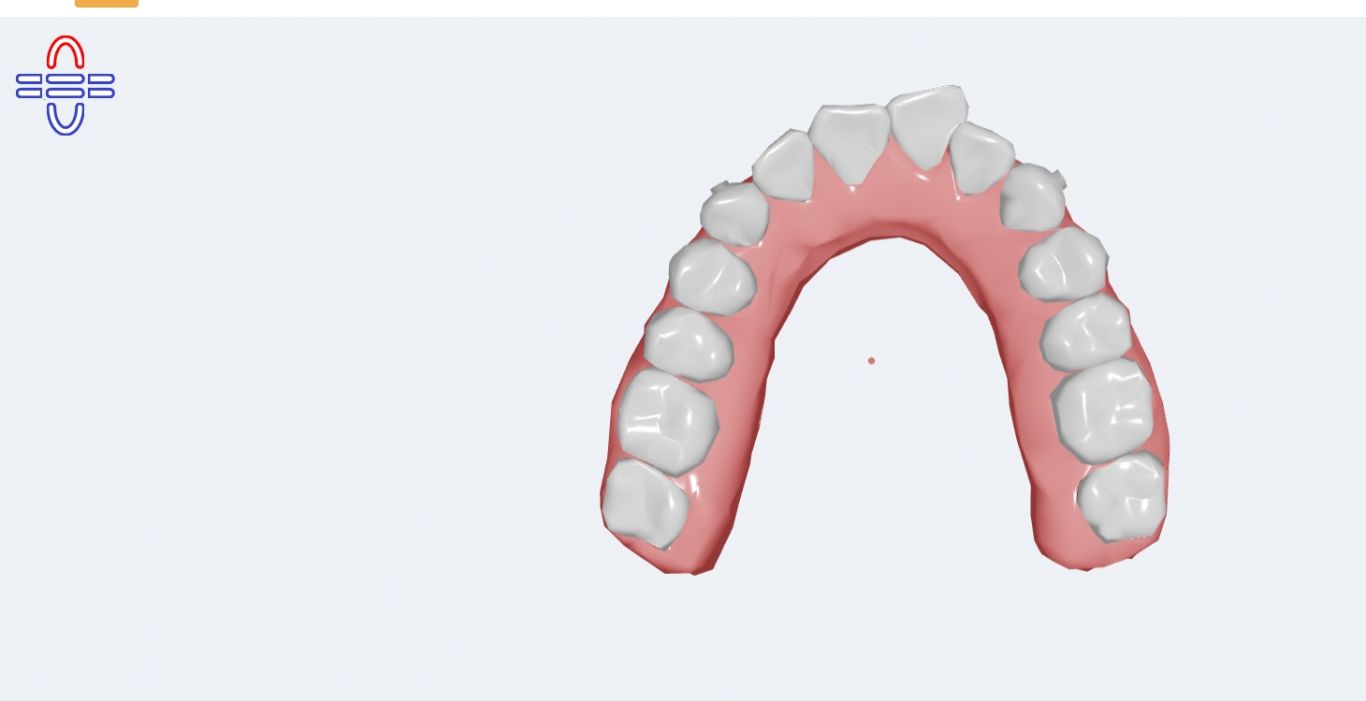 牙齿隐形矫正web 3D动画