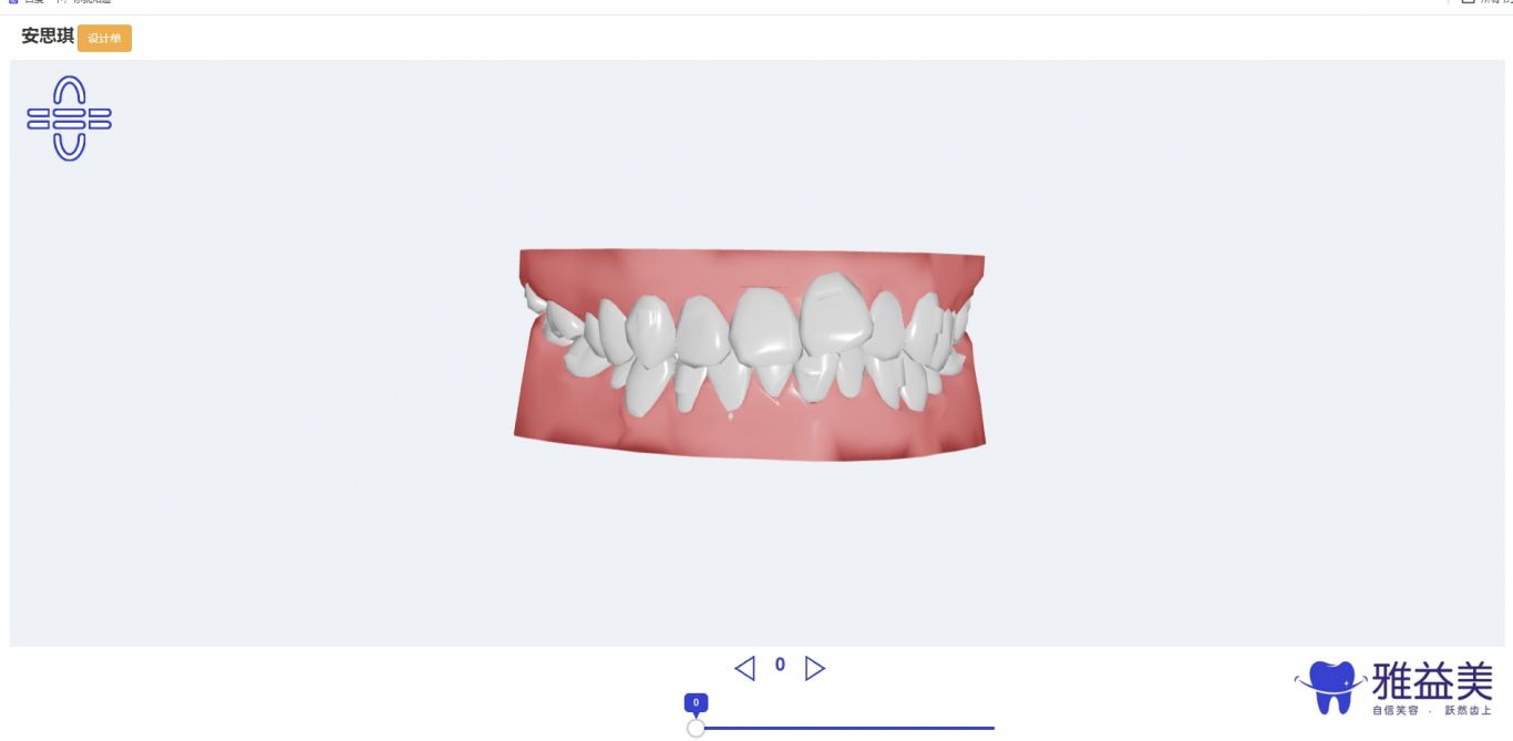 牙齿隐形矫正web 3D动画